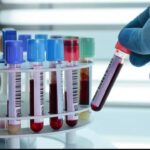 Where to Buy Blood Bank Equipment and Laboratory Glassware?