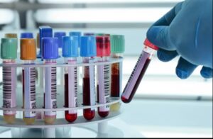 Where to Buy Blood Bank Equipment and Laboratory Glassware?