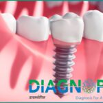 Best Dental Clinic in Pune | Advanced & Affordable Dental Care