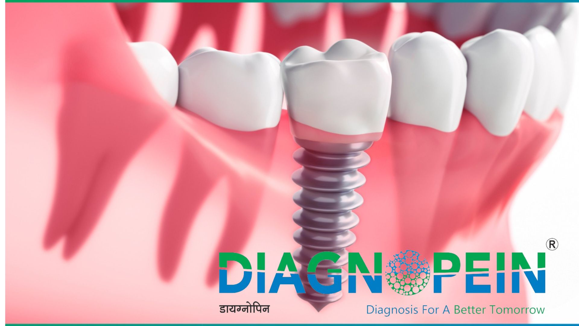 Best Dental Clinic in Pune | Advanced & Affordable Dental Care