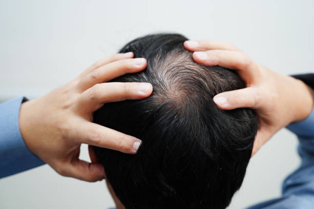 Can GFC Treatment for Hair Help With Aging Hair