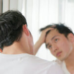 Can Hair Transplant Fix a Widening Hair Part Easily