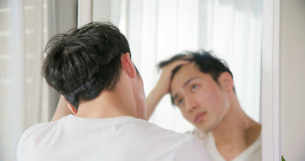Can Hair Transplant Fix a Widening Hair Part Easily