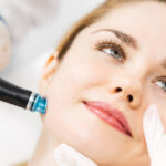Can HydraFacial Help Reduce Blackheads and Whiteheads