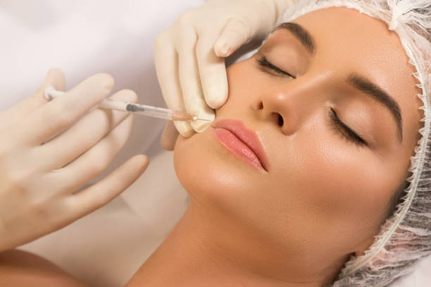 Can Lip Fillers Injection Reduce Visible Lip Lines