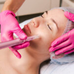 Can Microneedling Tighten Loose Facial Skin Naturally