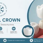 Dental Crown in Islamabad