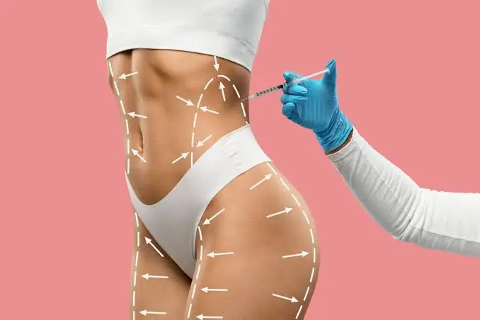 Does Body Fillers Help Define Body Curves