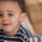 Cleft Lip and Palate Surgery in Abu Dhabi
