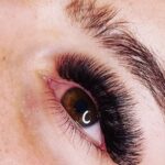 Eyelash Hair Transplant in Abu Dhabi