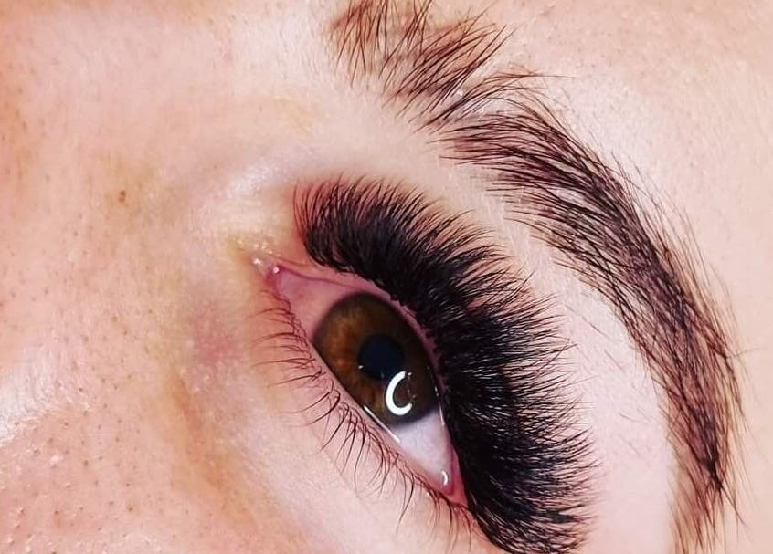 Eyelash Hair Transplant in Abu Dhabi