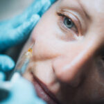 How Do Cheek Fillers Injections Create Balanced Features