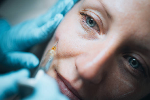 How Do Cheek Fillers Injections Create Balanced Features