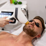 How Does Beard Laser Hair Removal Stop Razor Bumps