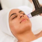 How Does Morpheus8 Treatment Tighten Skin