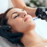 Microneedling for Acne Scars Abu Dhabi