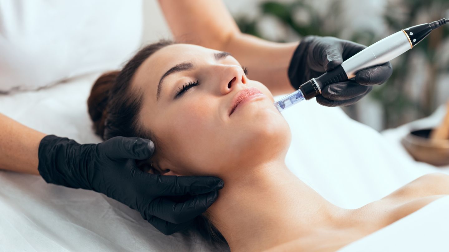 Microneedling for Acne Scars Abu Dhabi