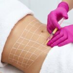 Fat Melting Injections in Abu Dhabi