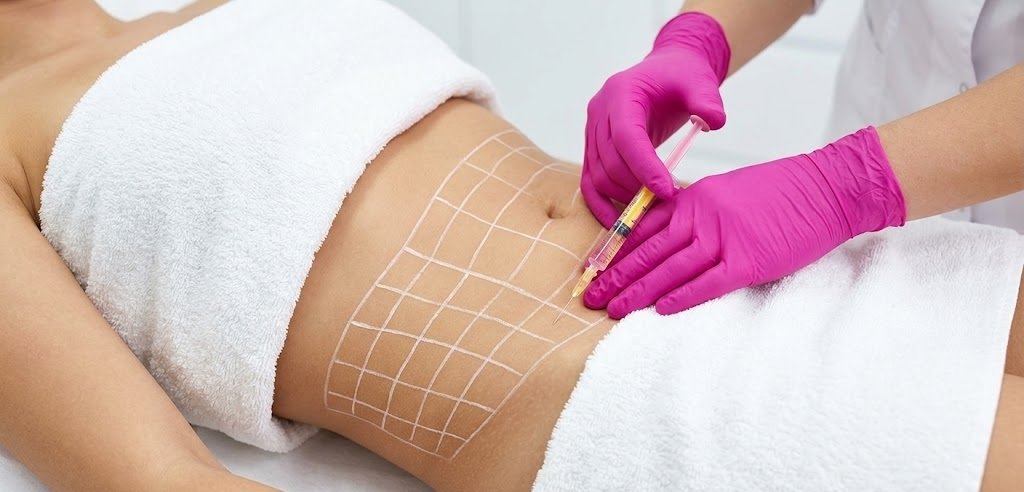 Fat Melting Injections in Abu Dhabi