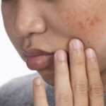 Dermal Pigmentation in Abu Dhabi