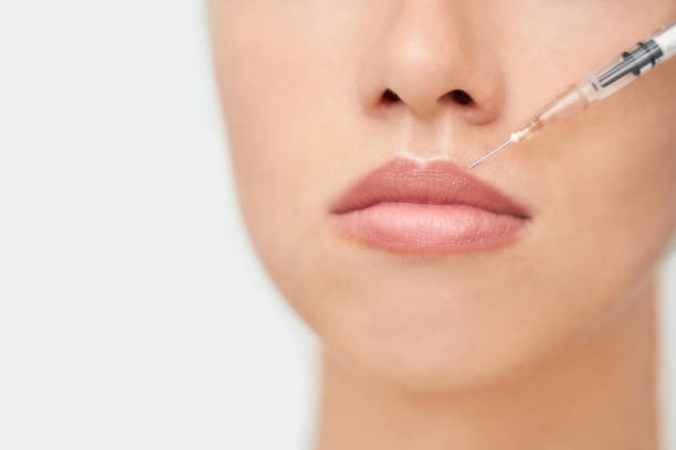 How do Russian lip fillers improve the look of lip symmetry