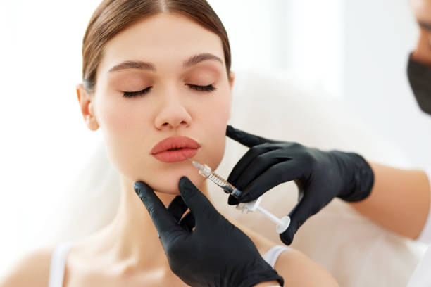 How do russian lip fillers treatment improve lip proportions