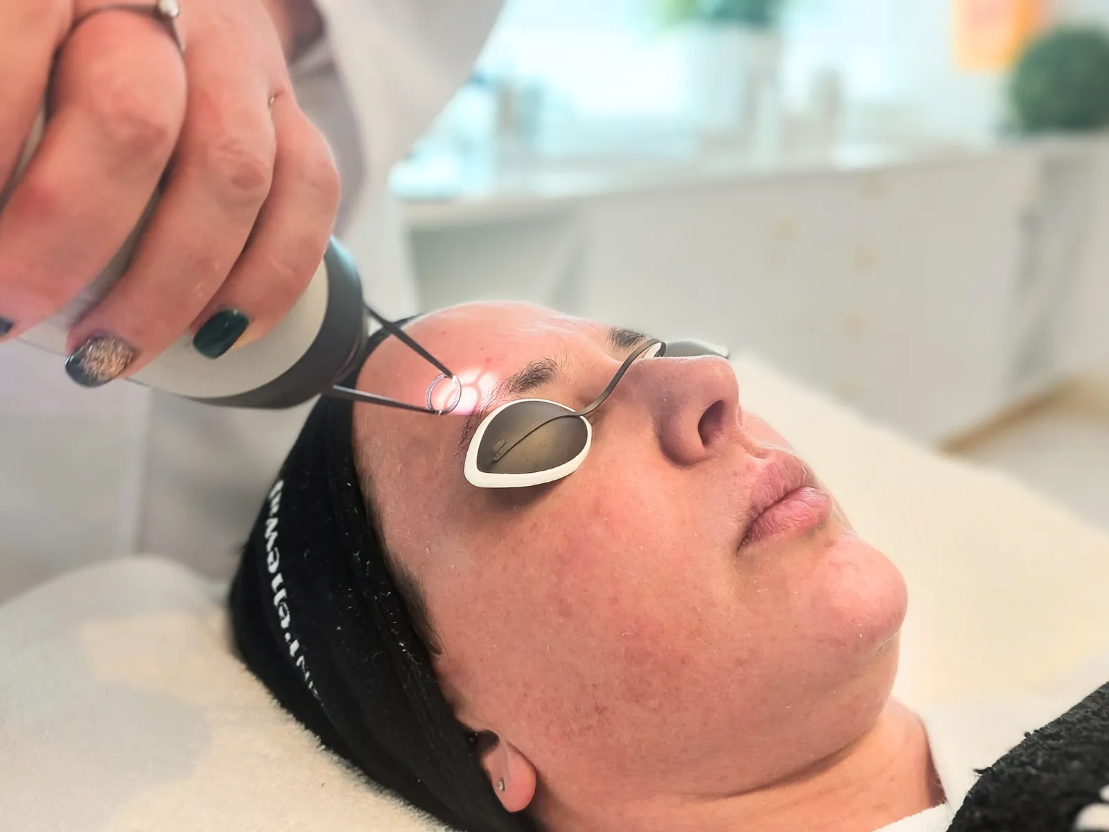 How does Pico Laser Treatment help reduce dark spots