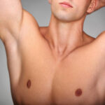 Is Gynecomastia Surgery Right for Persistent Fat