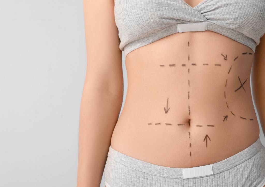 Tummy Tuck Abu Dhabi