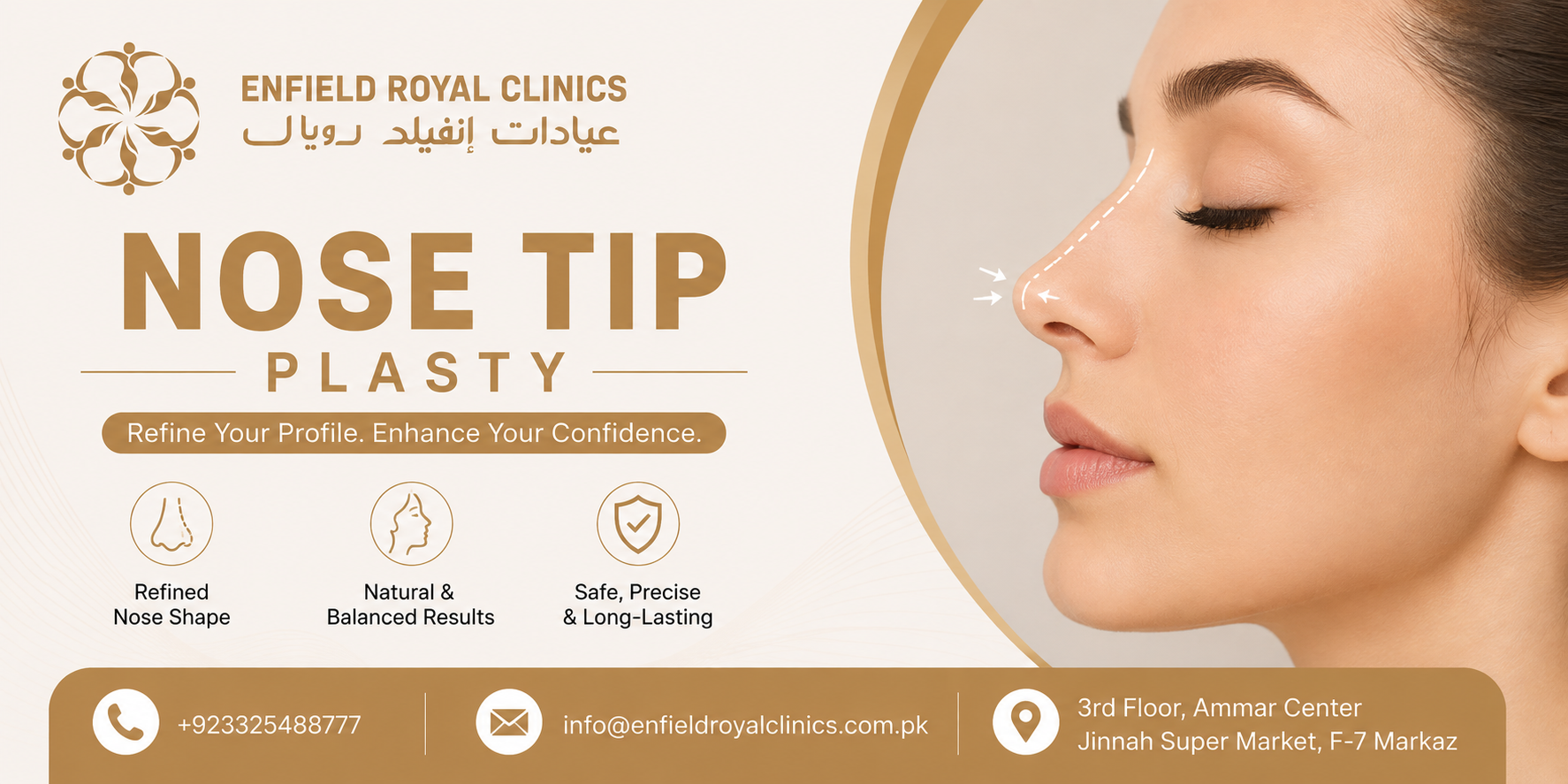 Can Nose Tip Plasty Fix a Droopy Tip