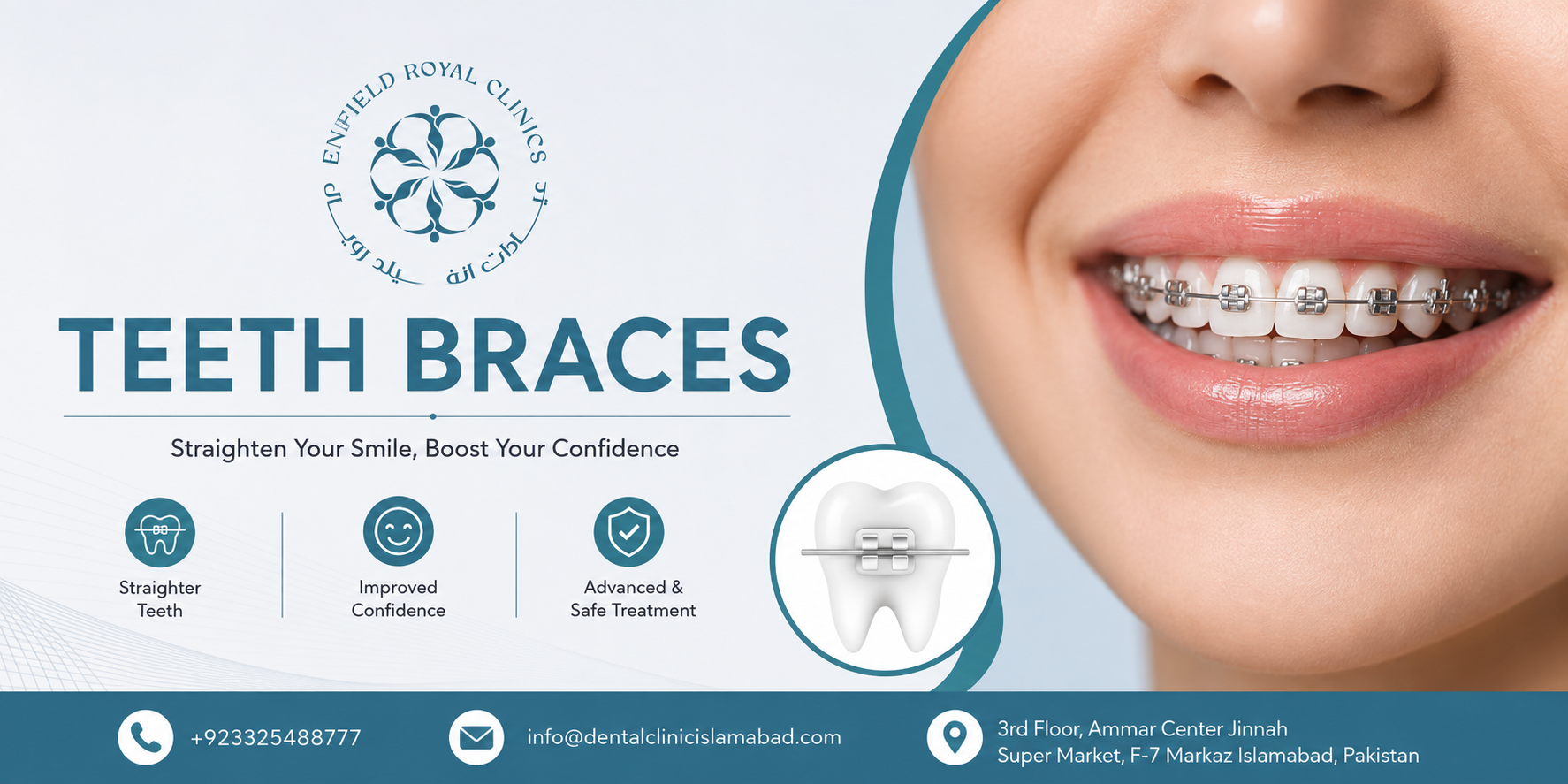 Teeth Braces in Islamabad