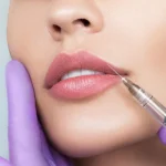 What Can Russian Lip Fillers Do for Flat Lips