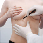 Breast Lift Surgery Abu Dhabi
