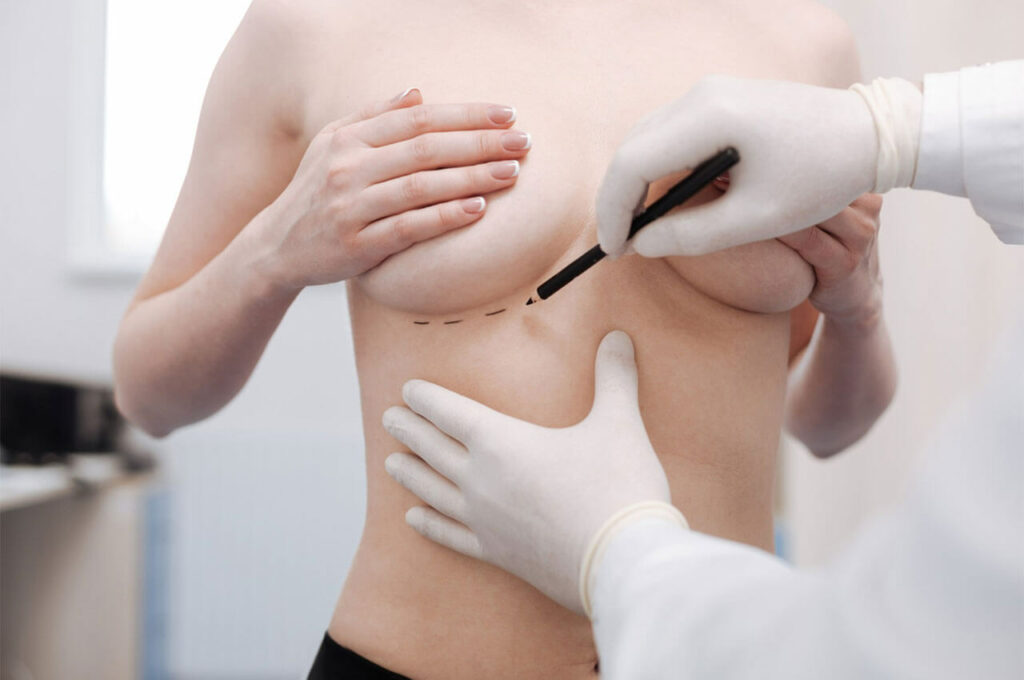Breast Lift Surgery Abu Dhabi
