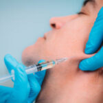 What makes jawline fillers suitable for rounder faces