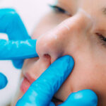 What makes rhinoplasty suitable for different types of nose shapes
