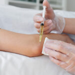 Platelet-Rich Plasma (PRP) Therapy: Advanced Non-Surgical Regenerative Care