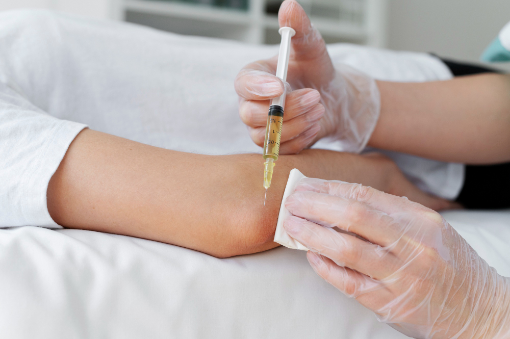 Platelet-Rich Plasma (PRP) Therapy: Advanced Non-Surgical Regenerative Care