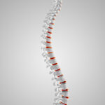 PRP Therapy for Cervical Disc Bulge in Hyderabad: Advanced Non-Surgical Care