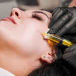 Woman receiving a PRP facial injection treatment at a clinic.