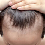 Can GFC Treatment for Hair Restore Hair Thickness