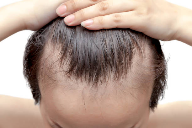 Can GFC Treatment for Hair Restore Hair Thickness