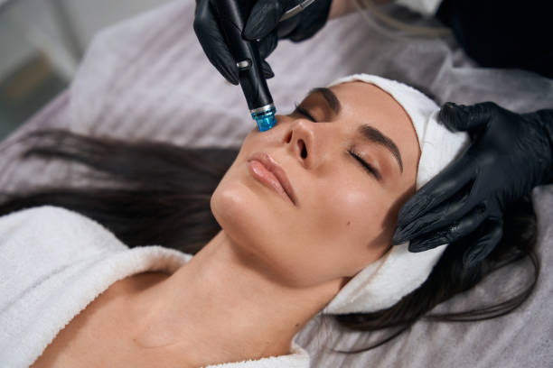 Can HydraFacial Help Minimize Visible Pores