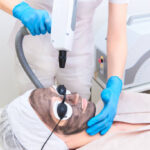 Can Laser Carbon Peel Help Improve Skin Radiance
