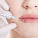 Can Russian Lip Fillers Create a Heart-Shaped Look