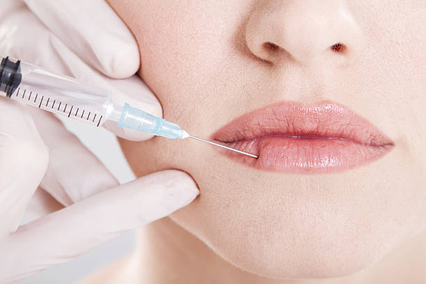 Can Russian Lip Fillers Create a Heart-Shaped Look