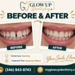 Cosmetic Dentistry