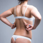 Liposuction in Abu Dhabi