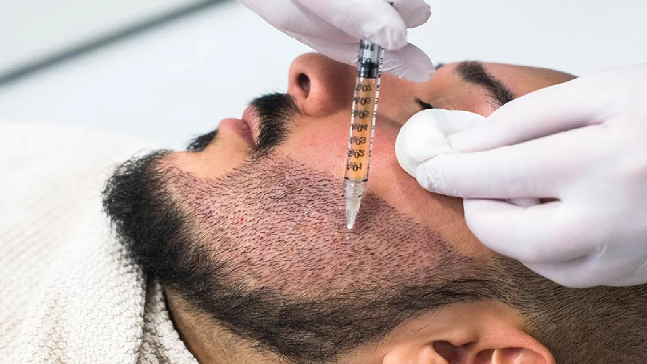 Beard Hair Transplant in Abu Dhabi
