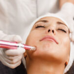 Dermapen treatment in Abu Dhabi
